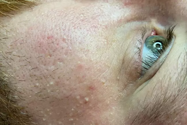 До процедуры фото №2