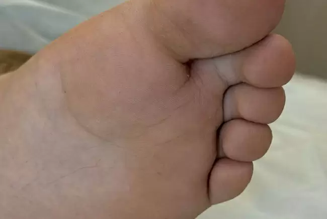 После процедуры фото №1