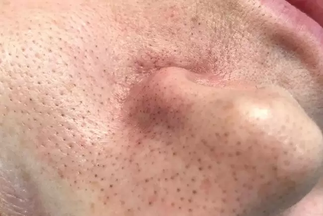 До процедуры фото №3