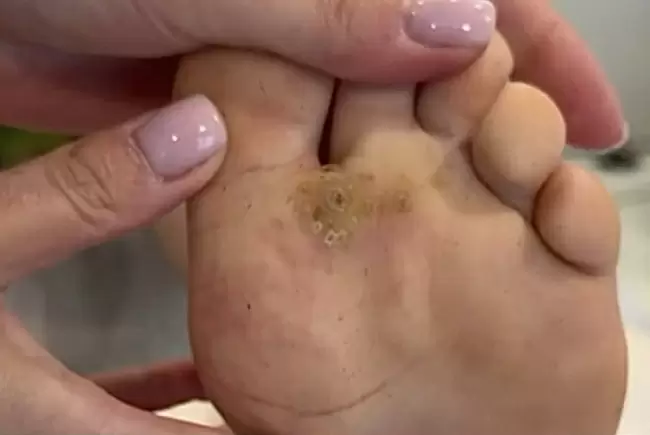 До процедуры фото №1