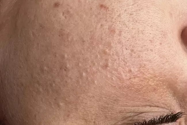 До процедуры фото №1