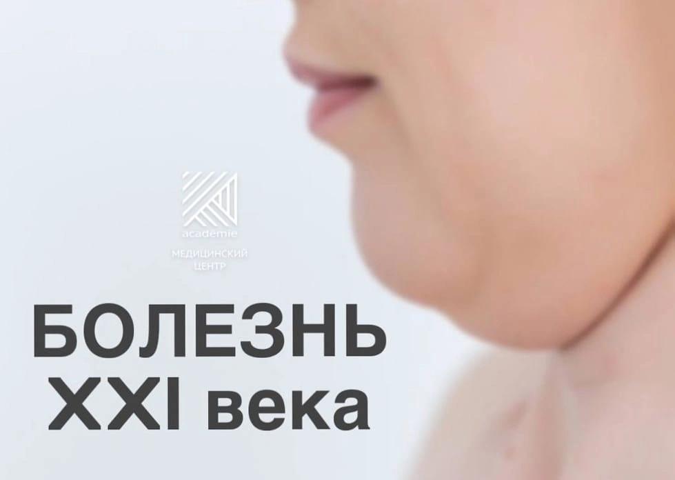 Второй подбородок — болезнь XXI века. И дело не только в возрасте